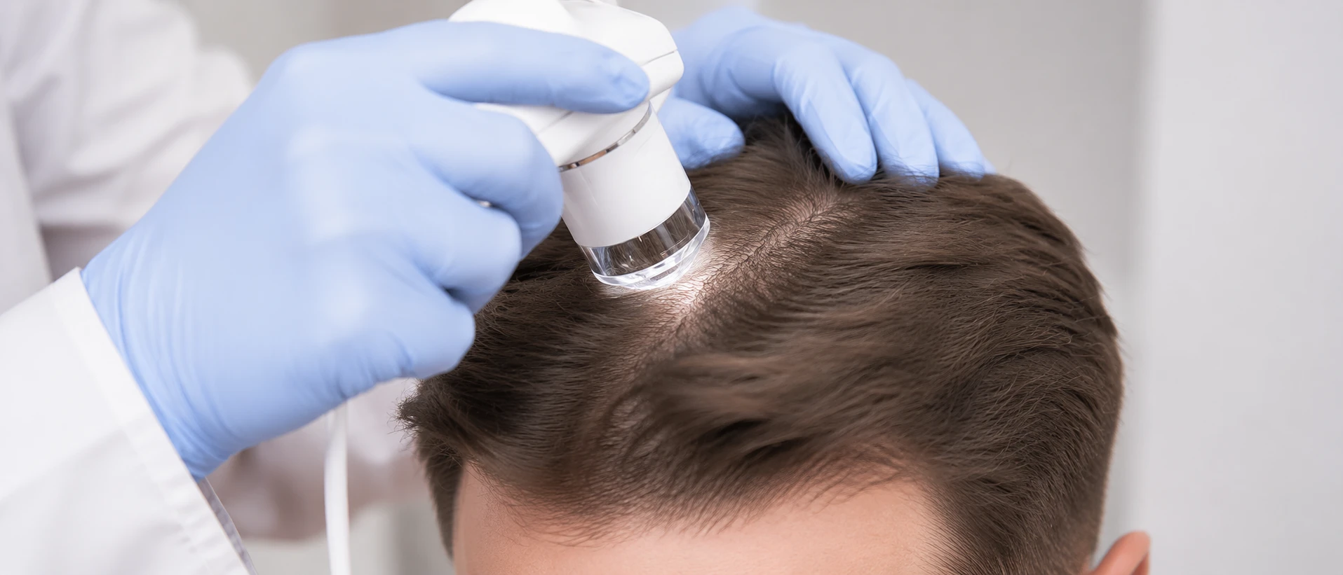 трихограмма при выпадении волос